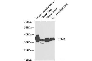 Western blot analysis of extracts of various cell lines using TPM3 Polyclonal Antibody at dilution of 1:1000. (TPM3 Antikörper)