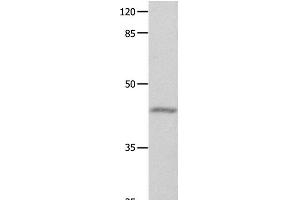 Western Blot analysis of Mouse eyes tissue using GNA11 Polyclonal Antibody at dilution of 1:550 (GNA11 Antikörper)