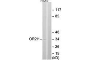 Western blot analysis of extracts from HuvEc cells, using OR2I1 Antibody.