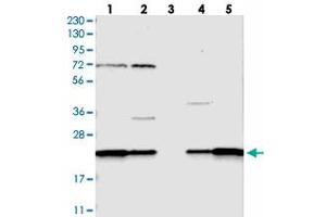 Western blot analysis of Lane 1: RT-4, Lane 2: U-251 MG, Lane 3: Human Plasma, Lane 4: Liver, Lane 5: Tonsil with SPCS2 polyclonal antibody  at 1:250-1:500 dilution. (SPCS2 Antikörper)