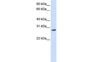WB Suggested Anti-KCNIP4 Antibody Titration:  0. (KCNIP4 Antikörper  (N-Term))