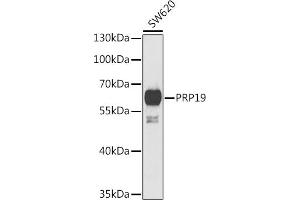 Western blot analysis of extracts of SW620 cells, using PRP19 antibody (ABIN6132439, ABIN6146257, ABIN6146259 and ABIN6222419) at 1:1000 dilution. (PRP19 Antikörper  (AA 1-220))