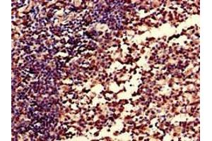 Immunohistochemistry of paraffin-embedded human tonsil tissue using ABIN7148409 at dilution of 1:100 (CD35 Antikörper  (AA 901-1095))