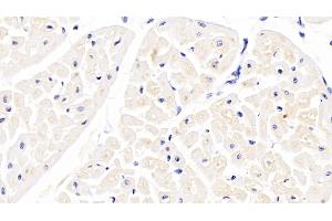 Immunohistochemistry (IHC) image for anti-Apoprotein B100 (Apo-B100) (AA 4331-4567) antibody (ABIN7445531)
