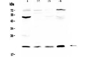 Western blot analysis of Kallikrein 2  using anti-Kallikrein 2  antibody .