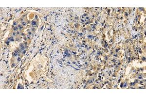 Immunohistochemistry (IHC) image for anti-Transforming Growth Factor, beta 1 (TGFB1) (AA 279-390) antibody (ABIN7429469)