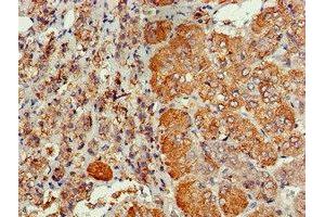 Immunohistochemistry of paraffin-embedded human adrenal gland tissue using ABIN7147287 at dilution of 1:100 (CDC6 Antikörper  (AA 1-141))