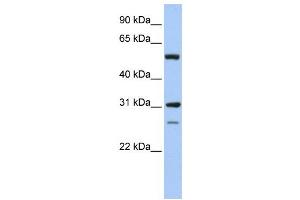 Western Blotting (WB) image for anti-Inosine 5'-Phosphate Dehydrogenase 1 (IMPDH1) antibody (ABIN2459738) (IMPDH1 Antikörper)