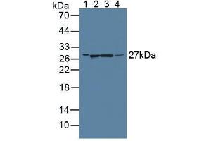 Western blot analysis of (1) Rat Serum, (2) Rat Liver Tissue, (3) Rat Pancreas Tissue and (4) Rat Kidney Tissue. (GAMT Antikörper  (AA 2-236))