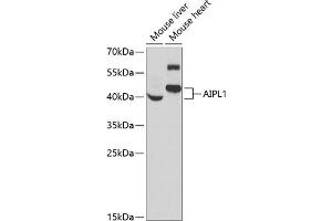 Western blot analysis of extracts of various cell lines, using  antibody (ABIN6129964, ABIN6136691, ABIN6136693 and ABIN6222112) at 1:1000 dilution. (AIPL1 Antikörper  (AA 1-384))