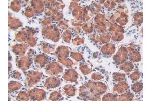 IHC-P analysis of Human Stomach tissue, with DAB staining. (CDCP1 Antikörper  (AA 689-836))