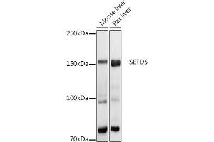 Western blot analysis of extracts of various cell lines, using SETD5 antibody (ABIN6132960, ABIN6147644, ABIN6147646 and ABIN6223140) at 1:1000 dilution. (SETD5 Antikörper  (AA 520-740))