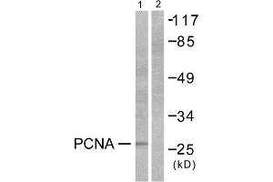 Western blot analysis of extracts from HepG2 cells, using PCNA antibody (ABIN5976487). (PCNA Antikörper  (Internal Region))