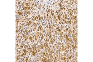 Immunohistochemistry (IHC) image for anti-ATP Citrate Lyase (ACLY) (AA 752-1101) antibody (ABIN7265716)