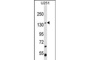 ST5 Antibody (C-term ) (ABIN652186 and ABIN2840676) western blot analysis in  cell line lysates (35 μg/lane).
