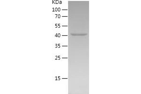 NLRP3 Protein (AA 5-218) (His-IF2DI Tag)