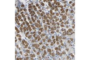 Immunohistochemical staining of human stomach with OTOF polyclonal antibody  shows strong cytoplasmic positivity in glandular cells at 1:50-1:200 dilution. (Otoferlin Antikörper)