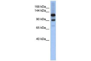 HIPK1 antibody used at 1 ug/ml to detect target protein. (HIPK1 Antikörper  (Middle Region))