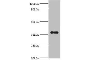 Western blot All lanes: AKR1B10 antibody at 4 μg/mL + A549 whole cell lysate Secondary Goat polyclonal to rabbit IgG at 1/10000 dilution Predicted band size: 36 kDa Observed band size: 36 kDa (AKR1B1 Antikörper  (AA 1-316))
