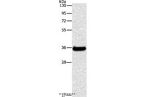 Western blot analysis of Human fetal liver tissue, using FGL1 Polyclonal Antibody at dilution of 1:500 (FGL1 Antikörper)