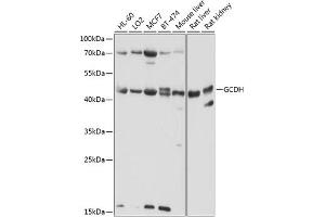 Western blot analysis of extracts of various cell lines, using GCDH antibody (ABIN6132101, ABIN6141009, ABIN6141010 and ABIN6224875) at 1:1000 dilution. (GCDH Antikörper  (AA 149-438))