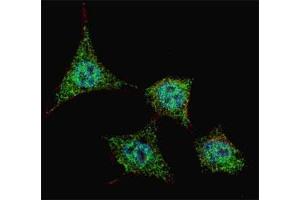 Fluorescent confocal image of HeLa cells stained with phospho-Bad antibody at 1:200.