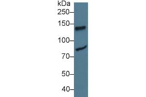 Western Blot; Sample: Human Jurkat cell lysate; Primary Ab: 3µg/ml Rabbit Anti-Rat LIG1 Antibody Second Ab: 0. (LIG1 Antikörper  (AA 568-875))