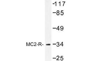 Image no. 1 for anti-Melanocortin 2 Receptor (Adrenocorticotropic Hormone) (MC2R) antibody (ABIN317741) (MC2R Antikörper)