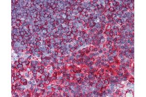 Anti-TUBB / Tubulin, Beta antibody IHC of human thymus.