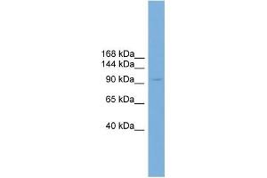 Human HT1080; WB Suggested Anti-PIWIL4 Antibody Titration: 0. (PIWIL4 Antikörper  (N-Term))