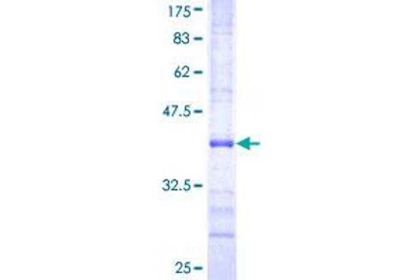 MCM2 Protein (AA 805-904) (GST tag)