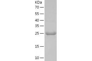 UBE2J1 Protein (AA 1-282) (His tag)