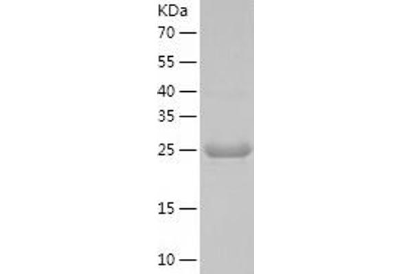 UBE2J1 Protein (AA 1-282) (His tag)