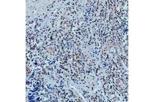 Immunohistochemical analysis of 42278 staining in human tonsil formalin fixed paraffin embedded tissue section. (POU2F1 Antikörper)