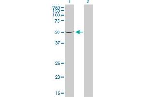 Western Blotting (WB) image for anti-Phosphoglucomutase 1 (PGM1) (AA 1-562) antibody (ABIN562198)