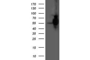 Western Blotting (WB) image for anti-Histidyl-tRNA Synthetase 2, Mitochondrial (Putative) (HARS2) antibody (ABIN1498582)