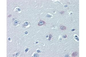 Immunohistochemistry (IHC) image for anti-Transient Receptor Potential Cation Channel, Subfamily M, Member 2 (TRPM2) (N-Term) antibody (ABIN2781840) (TRPM2 Antikörper  (N-Term))
