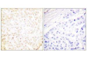 Immunohistochemistry (IHC) image for anti-X-Ray Repair Complementing Defective Repair in Chinese Hamster Cells 5 (Double-Strand-Break Rejoining) (XRCC5) (C-Term) antibody (ABIN1848903) (XRCC5 Antikörper  (C-Term))