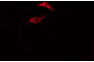 ABIN6275474 staining Hela cells by IF/ICC.