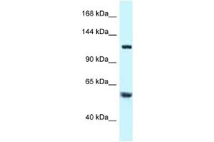 Western Blot showing TBCD antibody used at a concentration of 1 ug/ml against Hela Cell Lysate