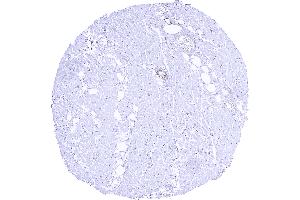 anti-Tripartite Motif Containing 72 (TRIM72) antibody