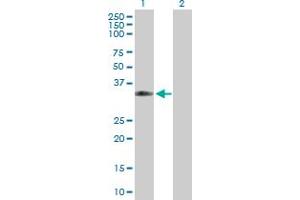 Western Blot analysis of CPNE5 expression in transfected 293T cell line by CPNE5 MaxPab polyclonal antibody. (Copine V Antikörper  (AA 1-301))