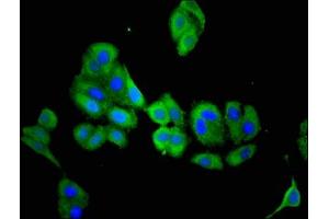 Immunofluorescent analysis of HepG2 cells using ABIN7160716 at dilution of 1:100 and Alexa Fluor 488-congugated AffiniPure Goat Anti-Rabbit IgG(H+L) (Aminoacylase 3 Antikörper  (AA 5-319))