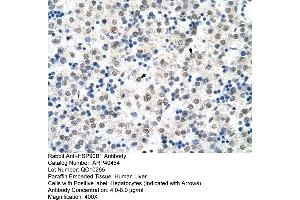 Rabbit Anti-HSP90B1 Antibody  Paraffin Embedded Tissue: Human Liver Cellular Data: Hepatocytes Antibody Concentration: 4.