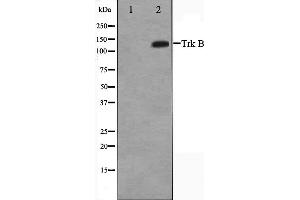 Western blot analysis of Trk B expression in HepG2 whole cell lysates,The lane on the left is treated with the antigen-specific peptide. (TRKB Antikörper  (C-Term))