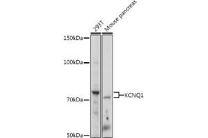 Western blot analysis of extracts of various cell lines, using KCNQ1 Rabbit pAb (ABIN3023120, ABIN3023121, ABIN3023122 and ABIN6219399) at 1:1000 dilution. (KCNQ1 Antikörper  (AA 250-549))