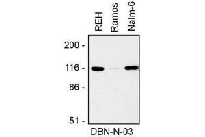 Image no. 1 for anti-Drebrin 1 (DBN1) (AA 1-326), (N-Term) antibody (ABIN1449383) (DBN1 Antikörper  (N-Term))