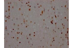 IHC image of ABIN7127643 diluted at 1:100 and staining in paraffin-embedded human brain tissue performed on a Leica BondTM system. (Rekombinanter NONO Antikörper)