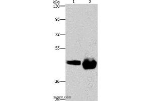 Western blot analysis of A549 and Raji cell, using CD38 Polyclonal Antibody at dilution of 1:520 (CD38 Antikörper)