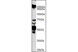 Antibody (1 µg/ml) staining of HUVEC lysate (35 µg protein in RIPA buffer). (ROBO1 Antikörper  (Internal Region))